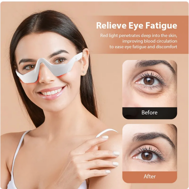 Chic Charm Red Light Eye Massager Beauty Device