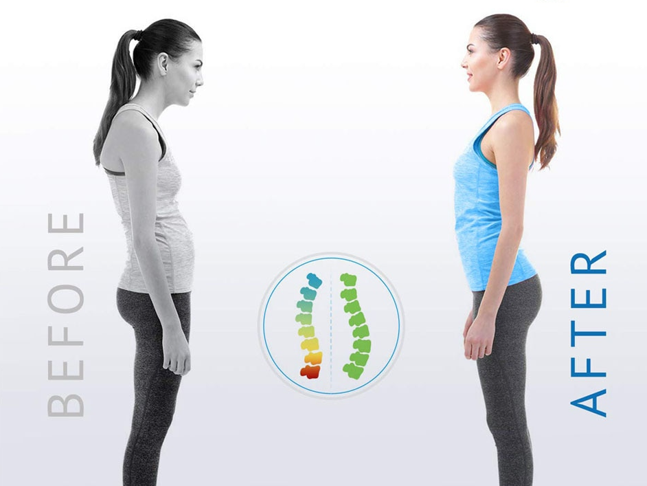 Chic Charm Posture Corrector Adjustable Back Support